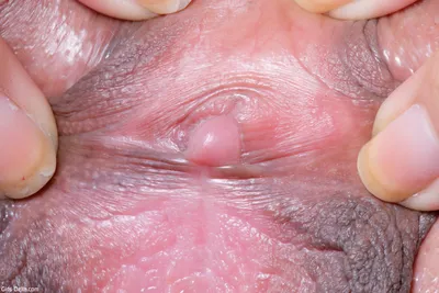 Related image