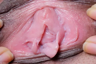 Related image