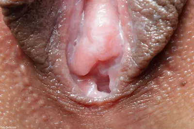 Related image